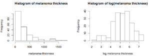 Histograms of melanoma thickness.png